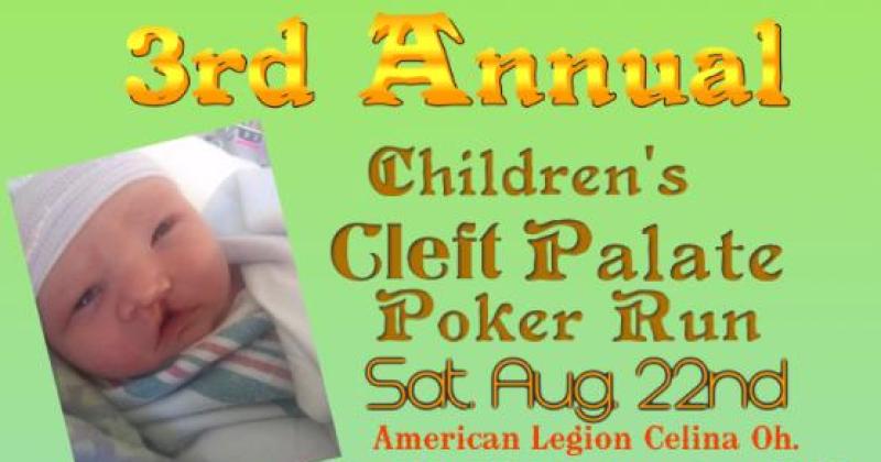 3rd Annual Children's Cleft Palate Run